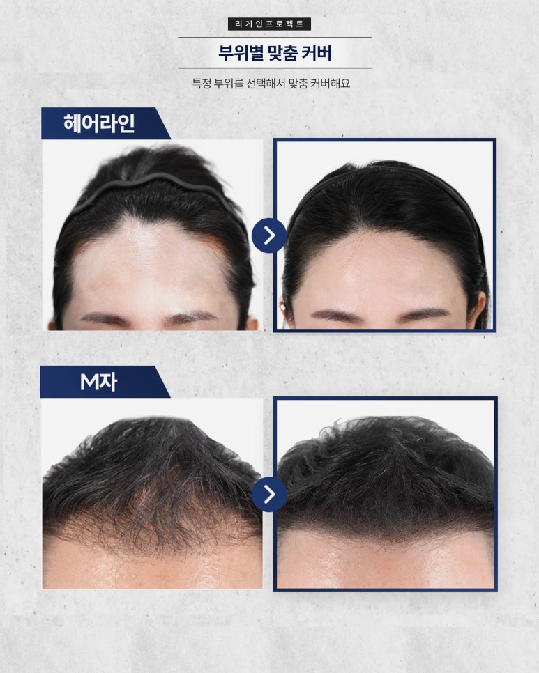 리게인프로젝트전주 이미지