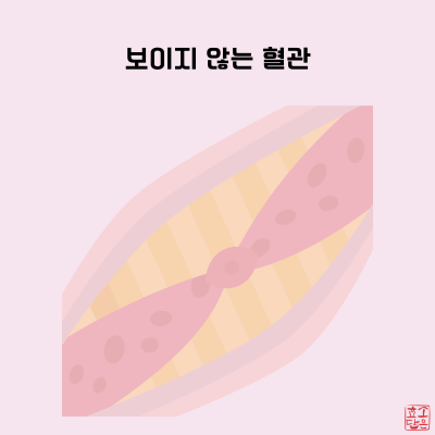 청소스토리 이미지