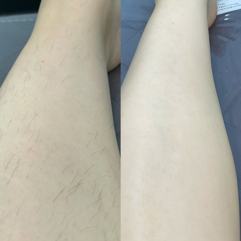 왁싱남녀 이미지