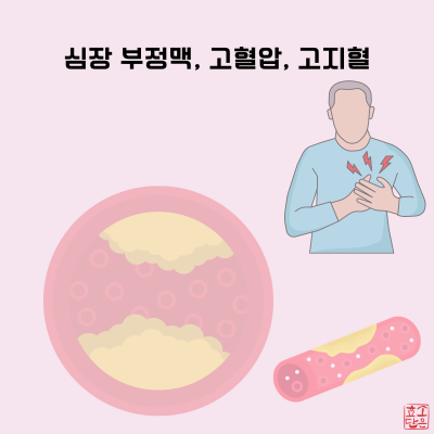 청소스토리 이미지