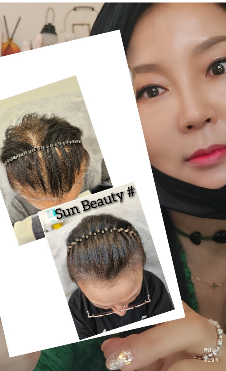 썬헤어라인 이미지