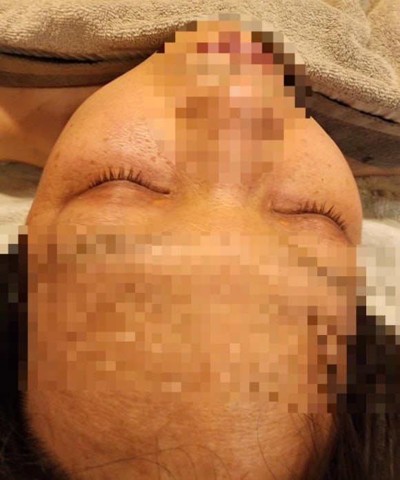 에덴쑥훈증테라피 이미지