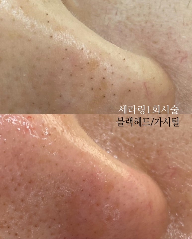 마이플래닝 이미지