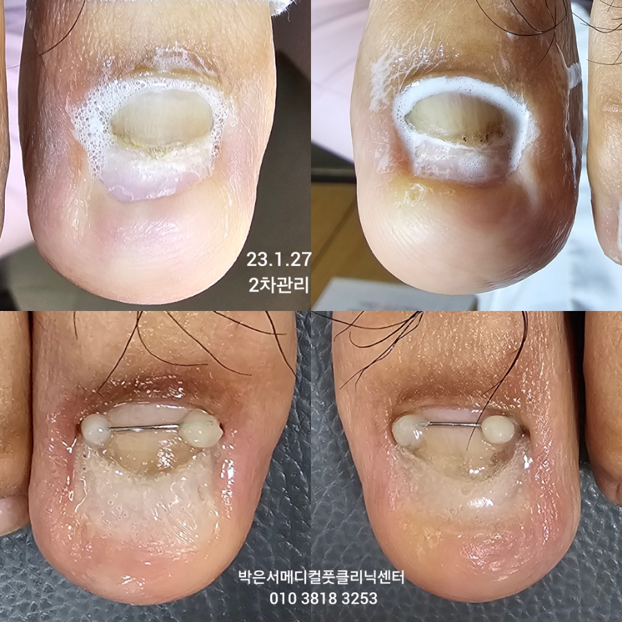박은서메디컬풋클리닉센터 이미지