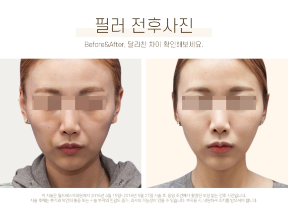 운정베스트의원 이미지