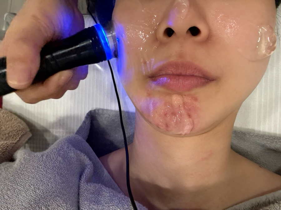 헤바스킨앤바디 이미지