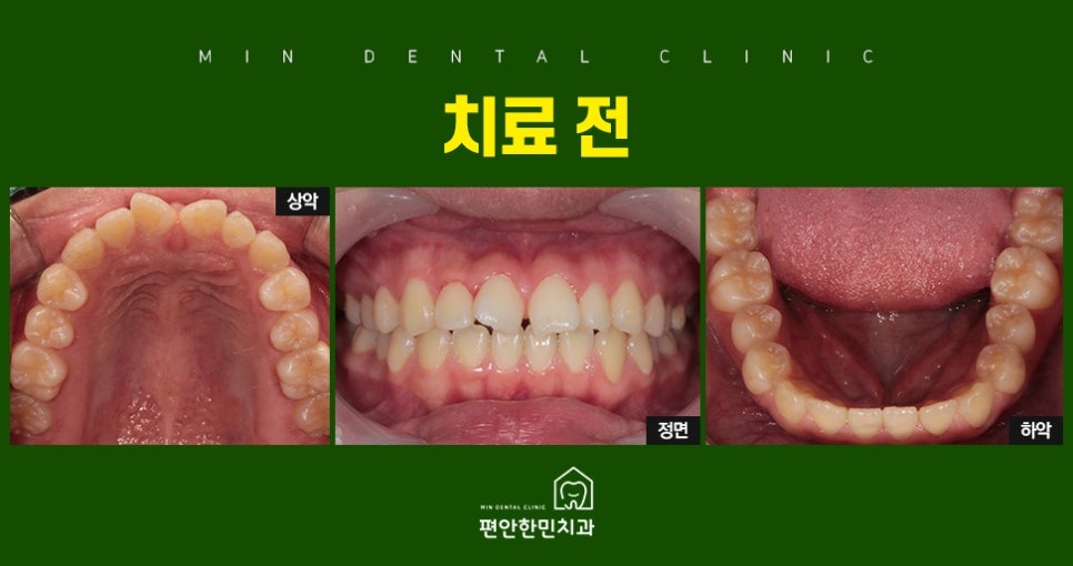 편안한민치과 이미지