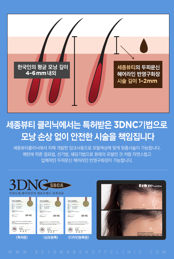 뷰티헤어라인 이미지