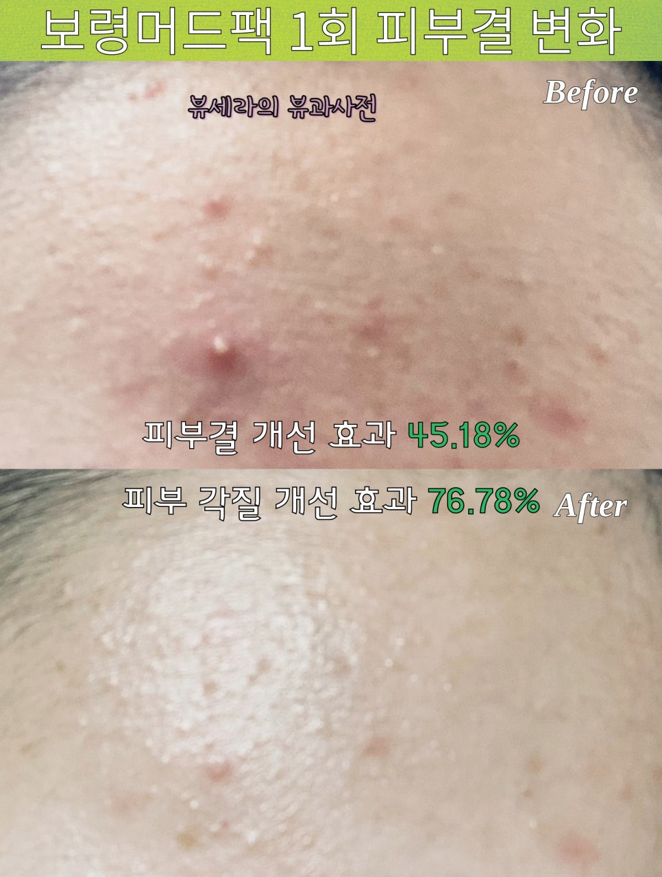 올리브영보령 이미지