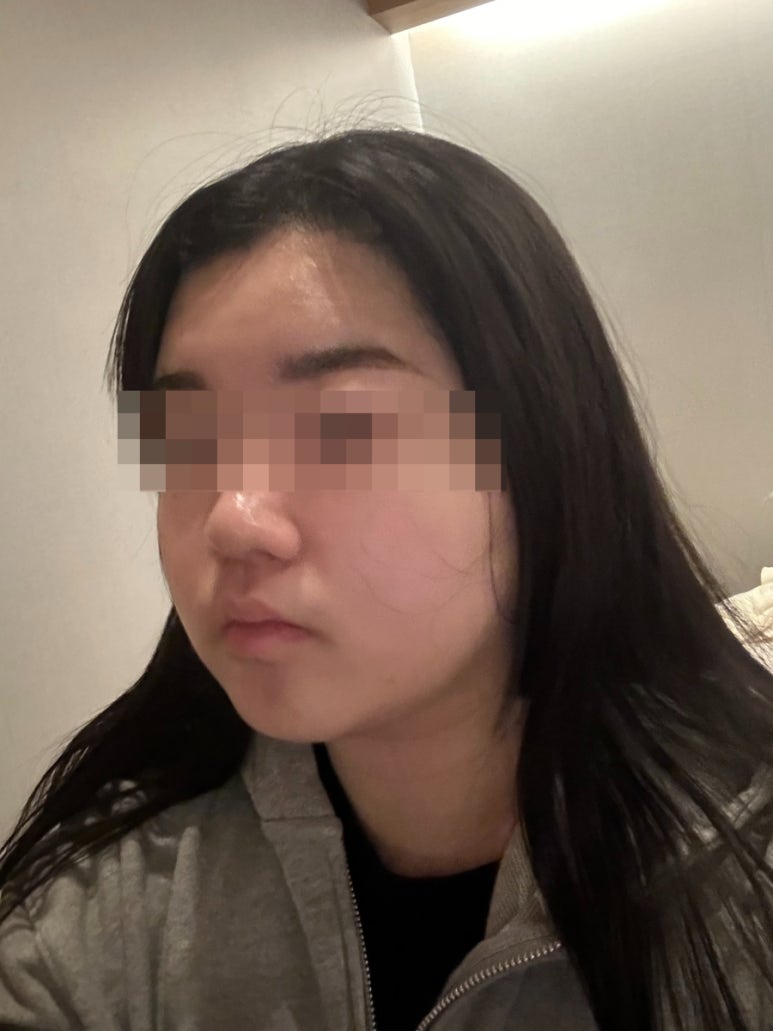 벨라인에스테틱 건대점 이미지