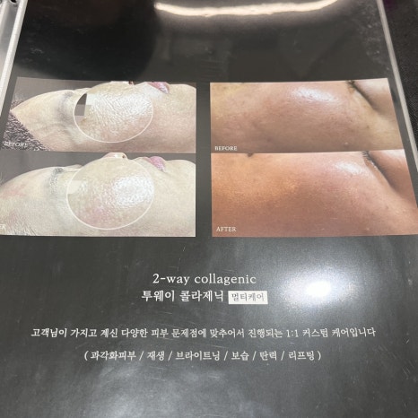 온본에스테틱 평택점 이미지