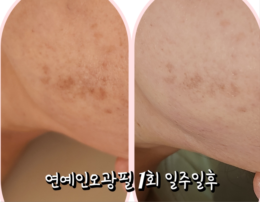 오광케어 이미지