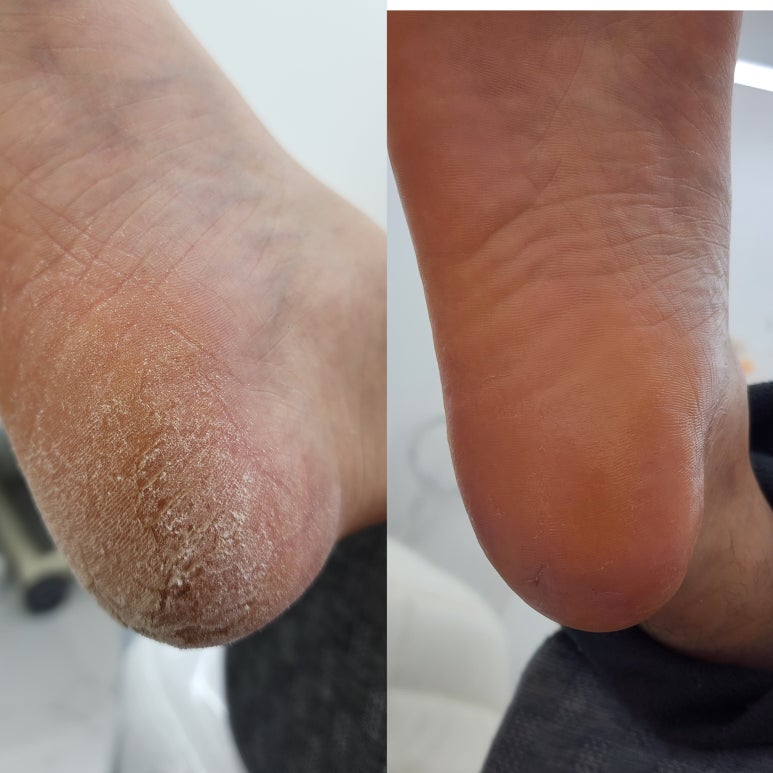 씨블링뷰티살롱 이미지