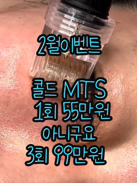 콜드 플라 송파 이미지