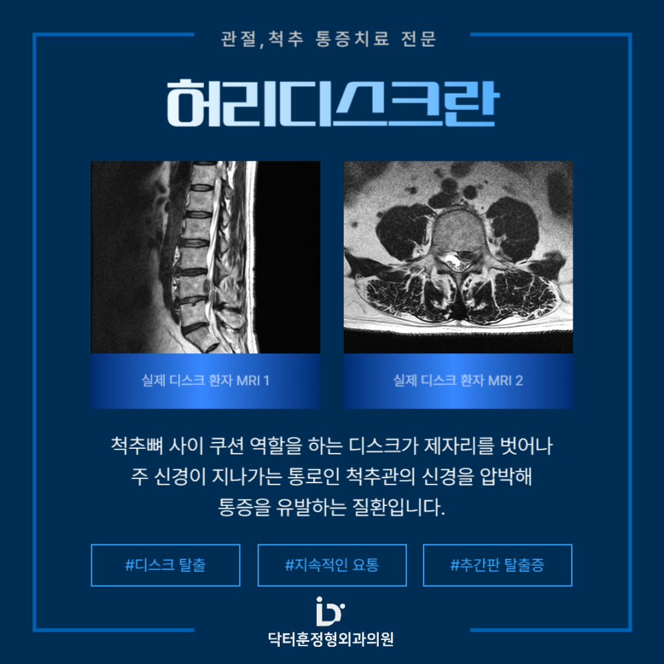닥터훈 이미지