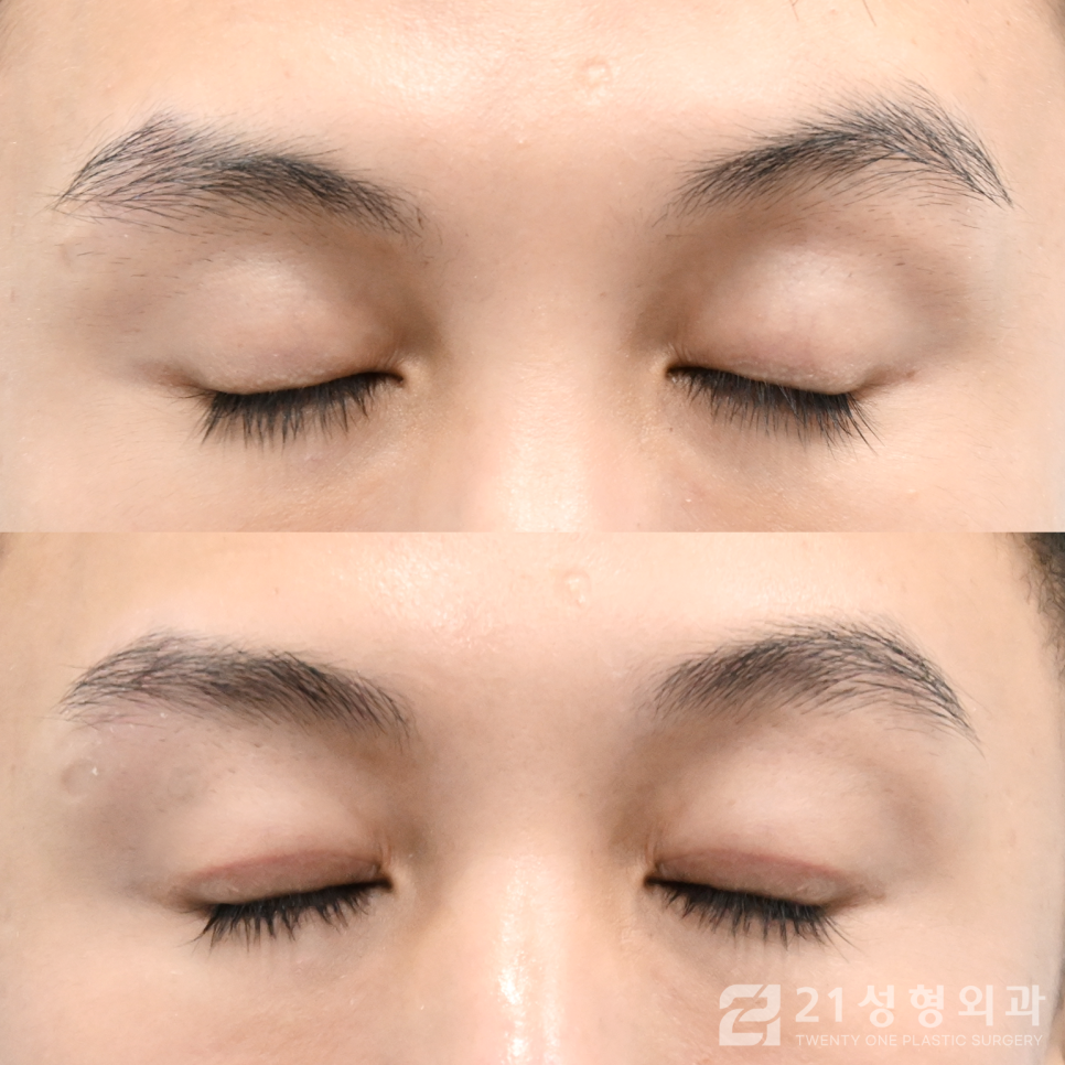 뉘앙스성형외과 이미지