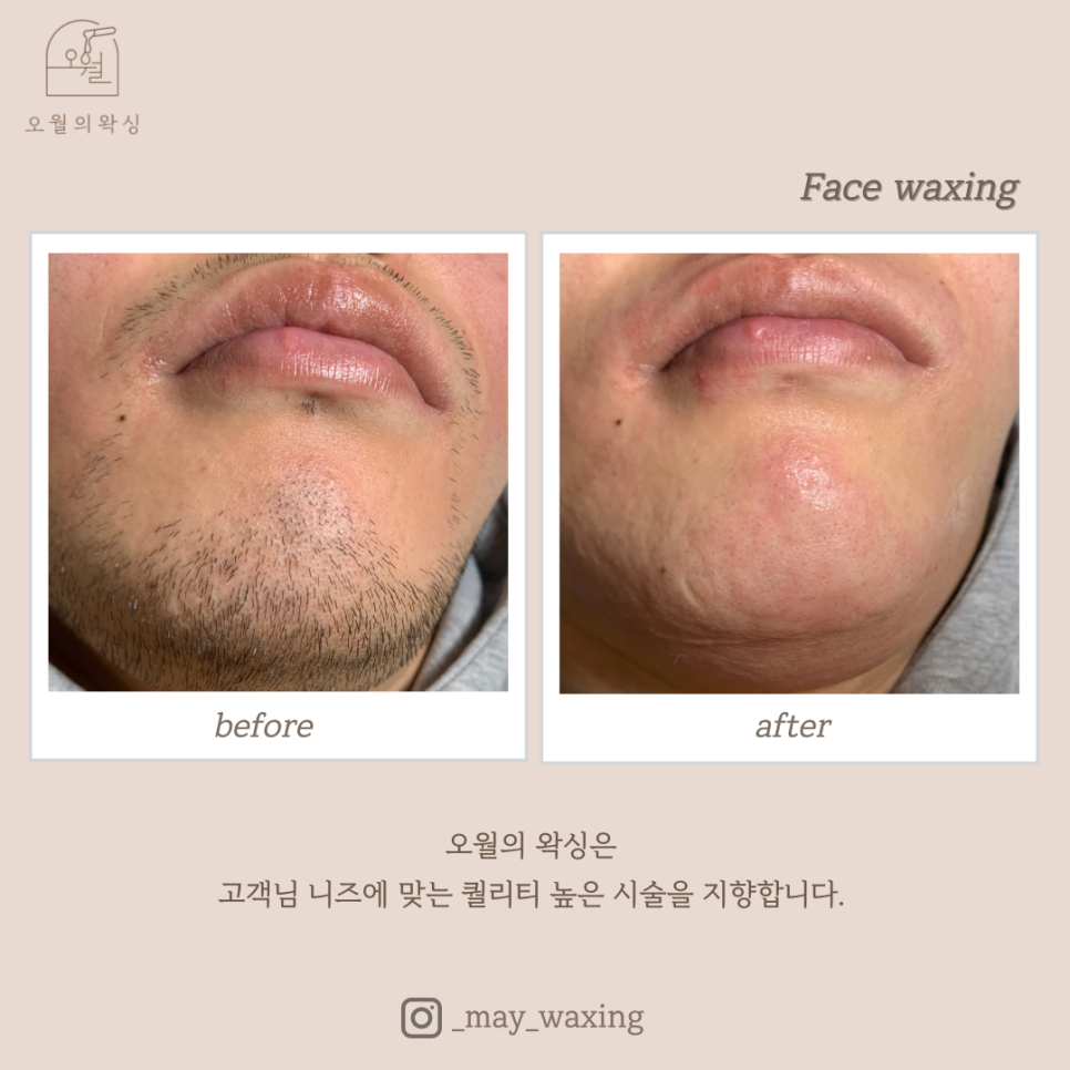 오월의 왁싱 이미지