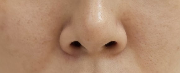 연화수퍼 이미지