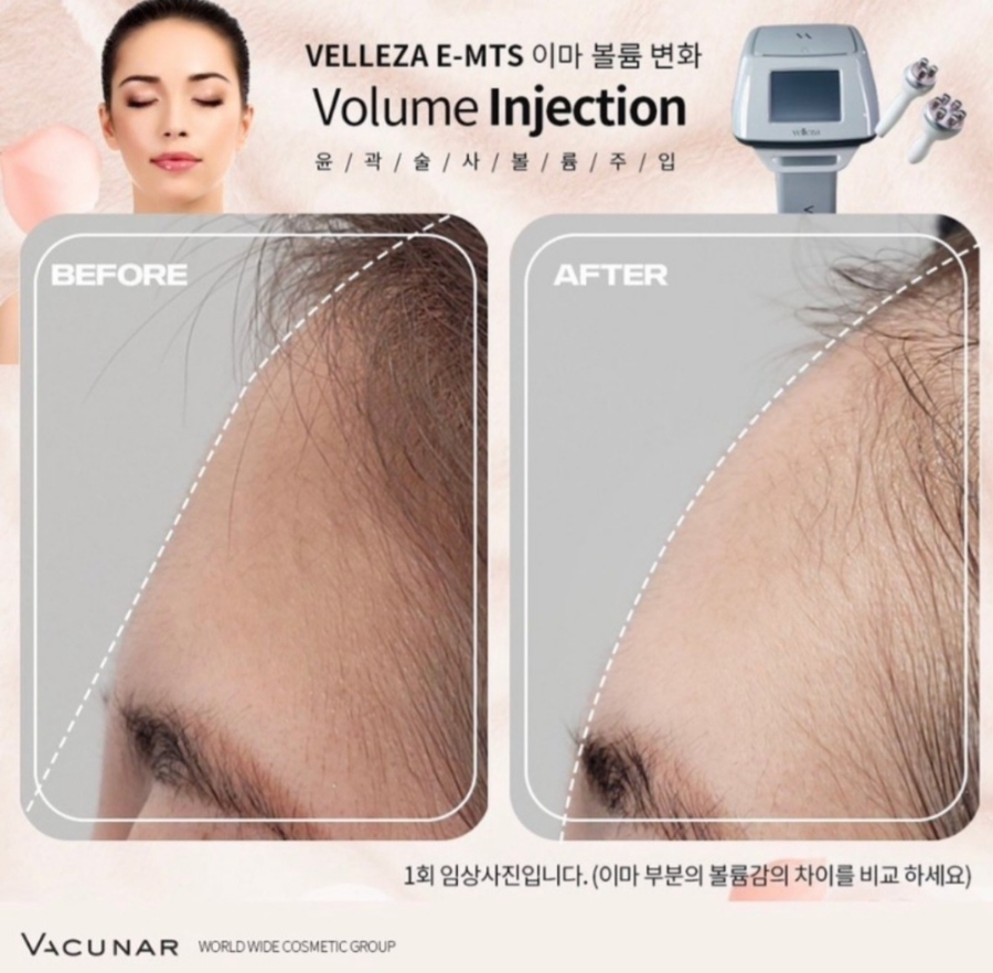 이지메디컬 이미지