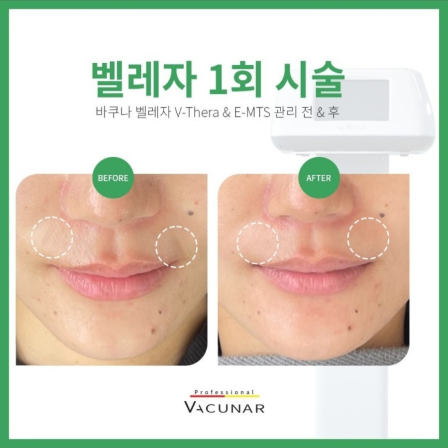 이지메디컬 이미지