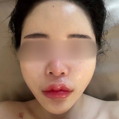 프엔느에스테틱 이미지