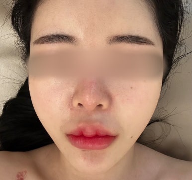 프엔느에스테틱 이미지