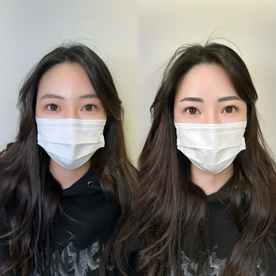 링링브로우 이미지