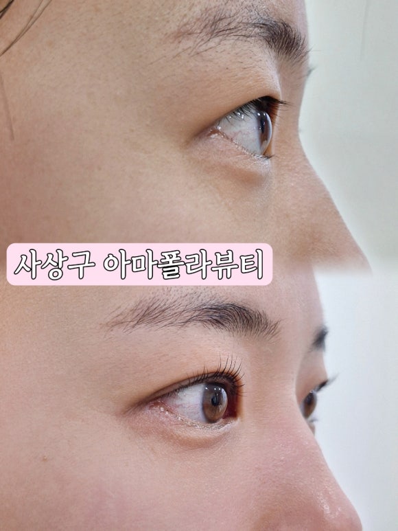 아마폴라뷰티 이미지