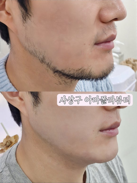 아마폴라뷰티 이미지