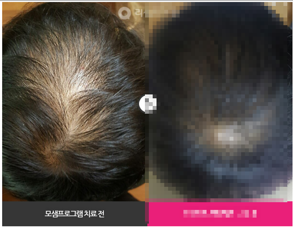 리샘헤어 이미지