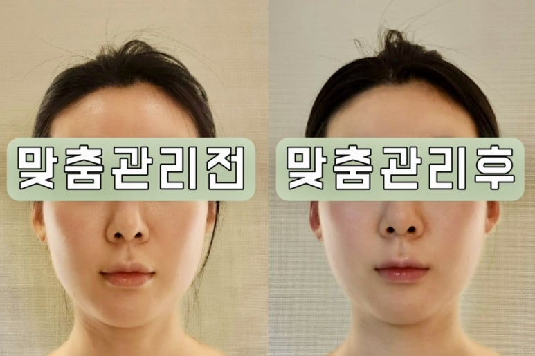 로하르스파 이미지