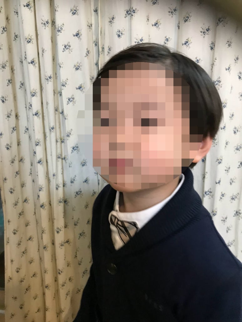 치크가산 이미지