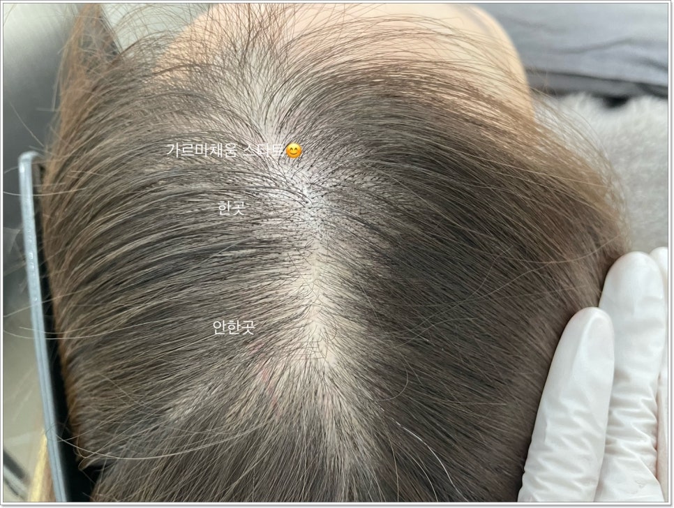 바다헤어라인 이미지