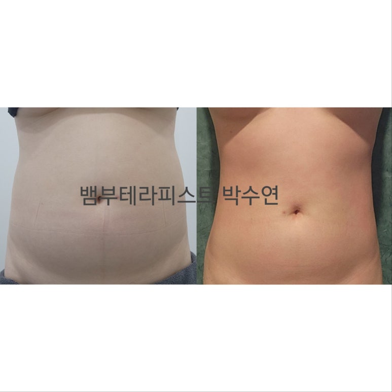 청에스테틱 이미지