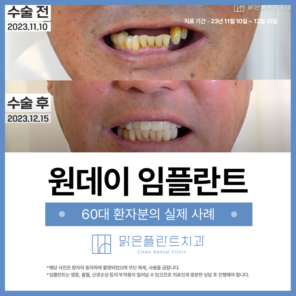 서울맑은플란트치과의원 이미지