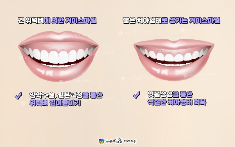 스마일치과의원 이미지