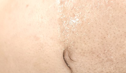 뷰티 썸 스킨 이미지
