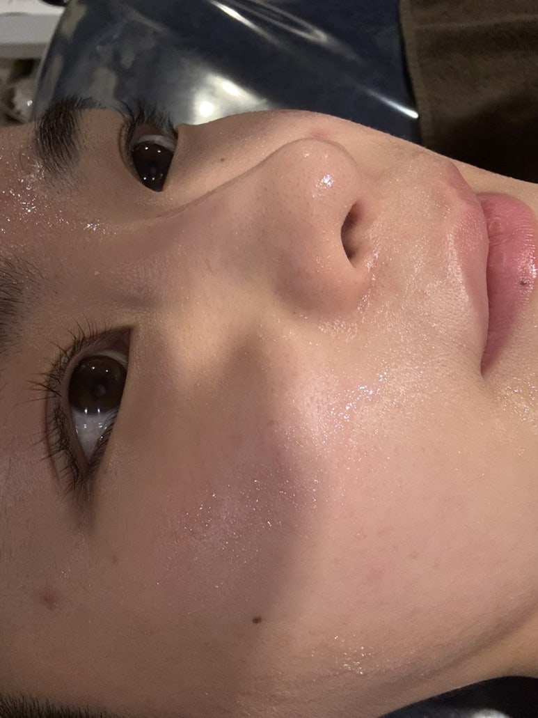 가림피부관리 이미지