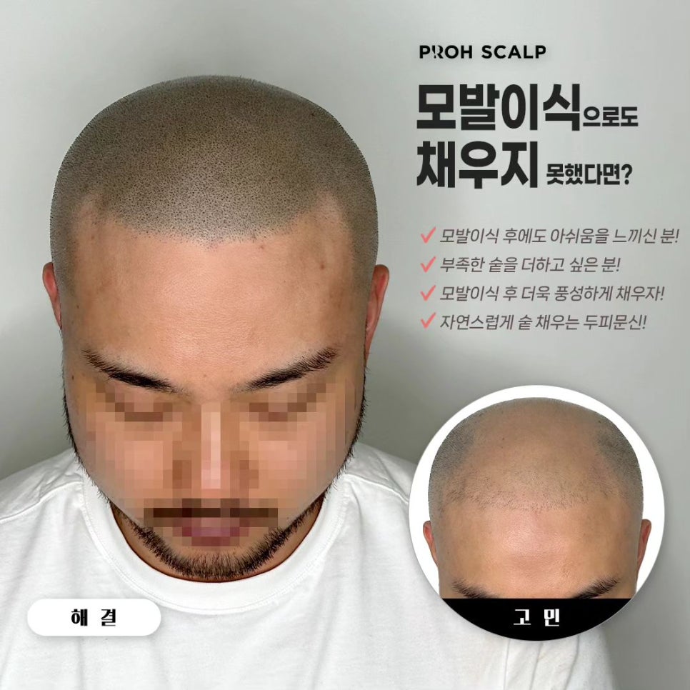 프로스칼프부산 이미지