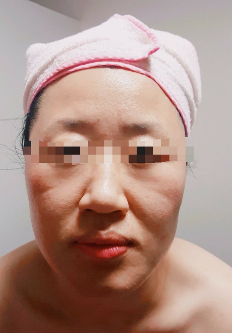 경락관리 이미지