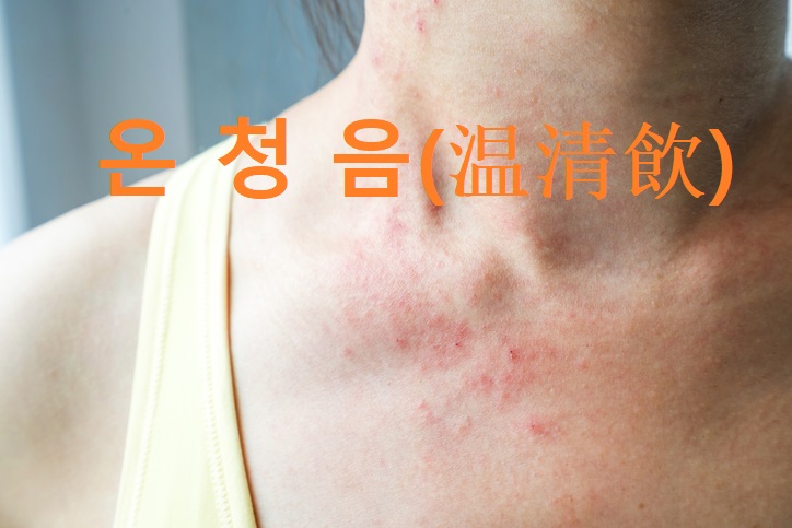 앞산OK한의원 이미지