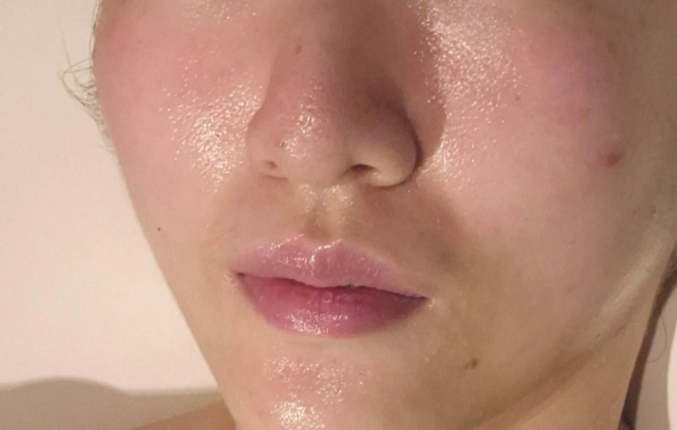 카라에스테틱 이미지