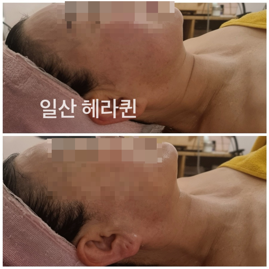 헤라피부관리실 이미지