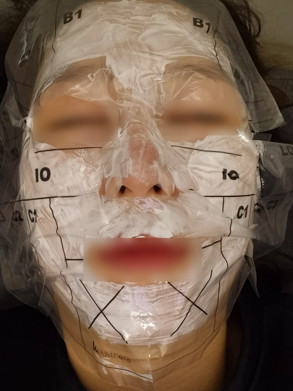 연세리즈의원 이미지