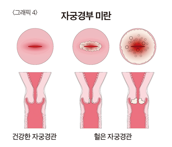 경부전기 이미지