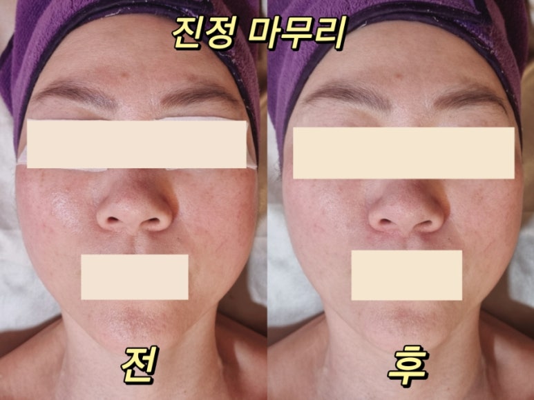 매끈라인스킨앤바디 이미지