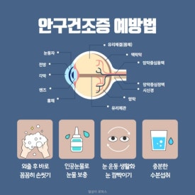 스마트안 이미지