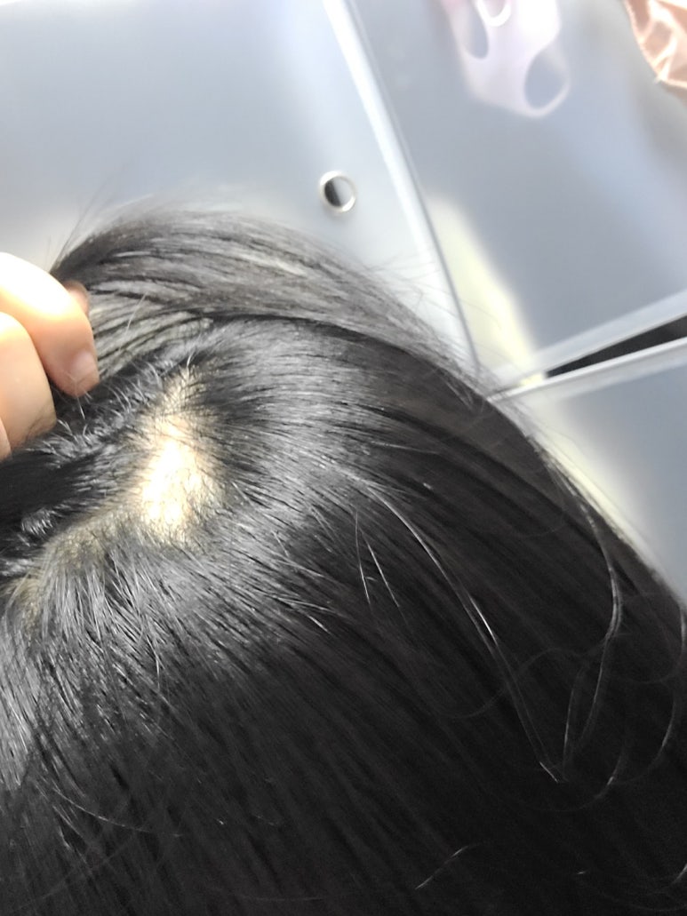 캅셀 이미지