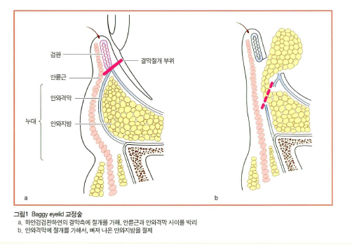 가본의학주 이미지