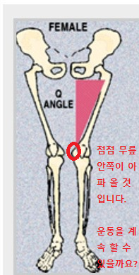 피티다움 이미지